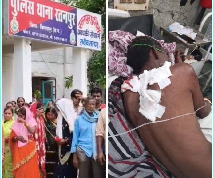 Bilaspur Chakubaji News : रतनपुर में चाकूबाजी की घटना, पुरानी रंजिश में युवक पर ताबड़तोड़ हमला आरोपी फरार